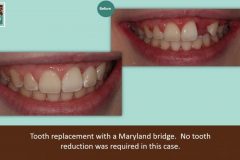 Maryland2-940x528