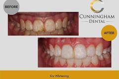 TEMPLATE before and after - 1