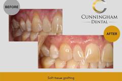 TEMPLATE before and after - 1